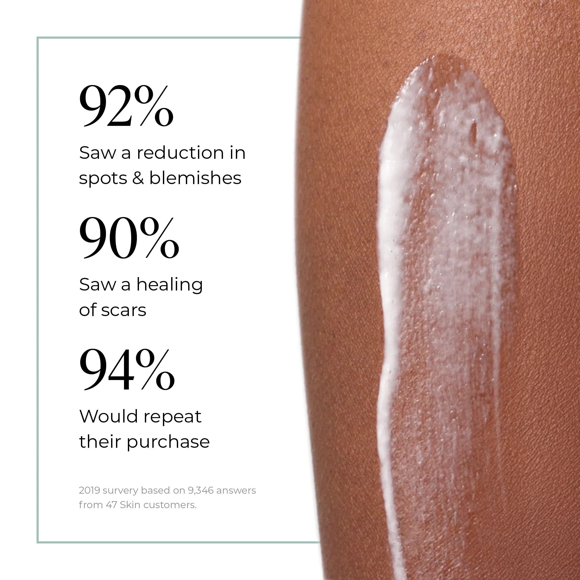 Anti-Blemish & Scar Repair Body Moisturiser - Image 7